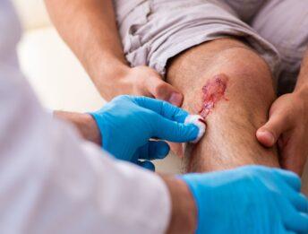 Caduta moto: come curare le abrasioni da asfalto